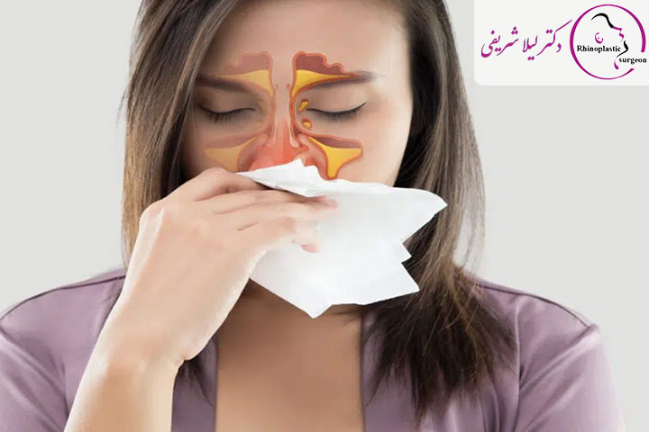 سرماخوردگی قبل از عمل بینی