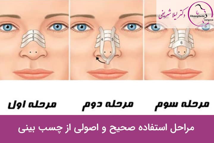 فیلم نحوه چسب زدن بینی استخوانی