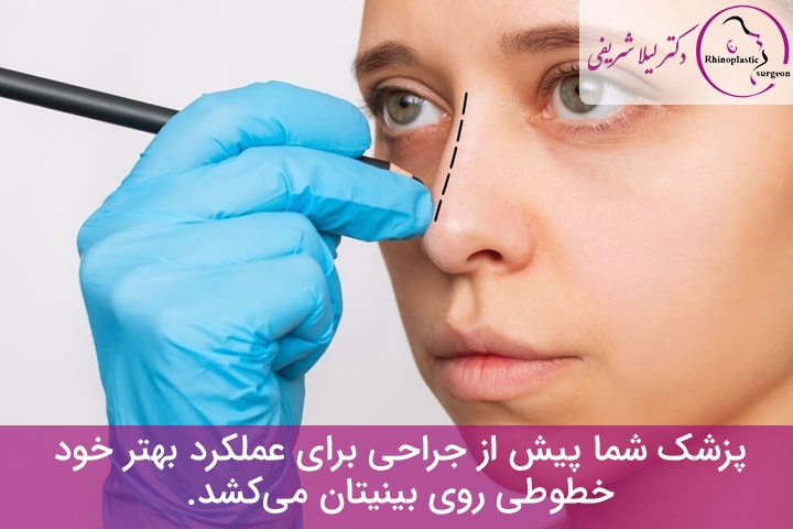 عمل جراحی بینی با توجه به فرم صورت